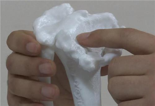 寧陽縣第一人民醫(yī)院：3D 打印技術(shù)造福骨科患者2.jpg